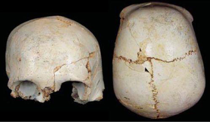 اﯾﻦ ﺟﻤﺠﻤﻪ ﺷﮑﺴﺘﻪ ﮐﻮدك ﻧﺌﺎﻧﺪرﺗﺎل ﺑﯿﺎنﮐﻨﻨﺪه ﻣﺮاﻗﺒﺖ اﻧﺴﺎن ﻫﺎي اوﻟﯿﻪ از ﻫﻤﺪﯾﮕﺮ ﺑﻮده اﺳﺖ