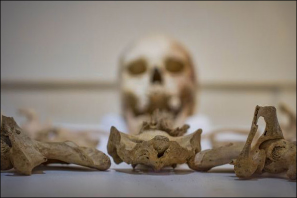 اسکلت بانوی بیچی هد