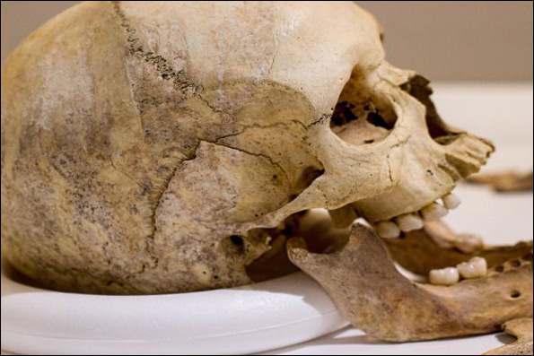 جمجمه بانوی بیچی هد