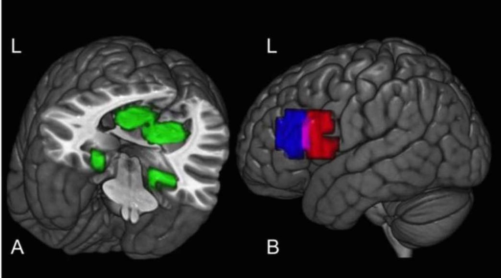 محل ایجاد فکرهای جدید در مغز کجاست؟