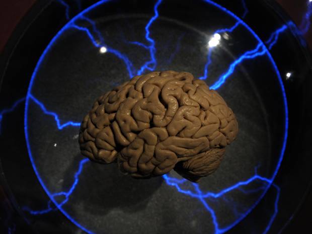 نمونه آزمایشگاهی مغز انسان                                                                                                                                                                                                                                                                                  