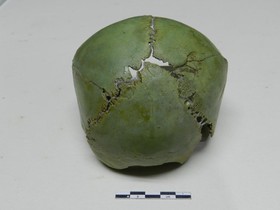 کشف عامل اصلی مرگ نوزادان باستانی 